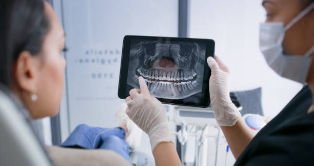 Licensed Tooth Extraction service in San Bruno, CA - Smile Center Dentistry